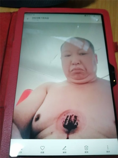 关于《五脏六腑》中医药技术修复