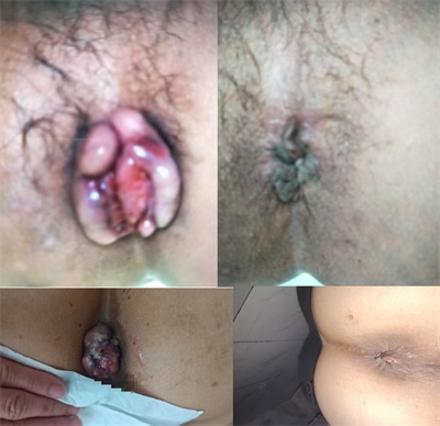 高手在民间广西百色杨忠雅