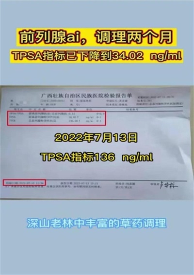 金秀瑶族灯草灸疗法 瑶医药非物质文化遗产传承人---赵衷民