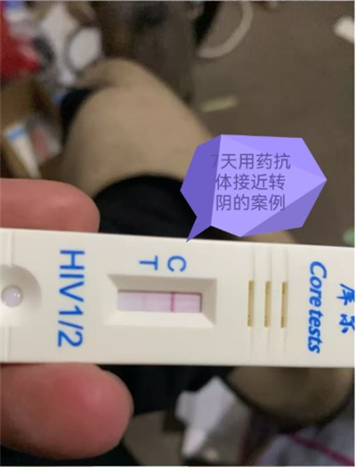 命急丸世界唯一；HIV七天有抗体转阴