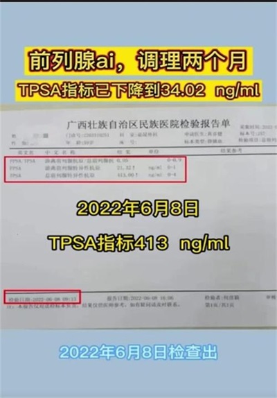 金秀瑶族灯草灸疗法 瑶医药非物质文化遗产传承人---赵衷 民