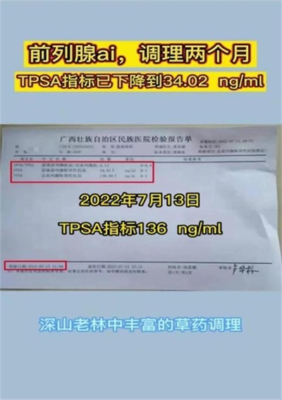 金秀瑶族灯草灸疗法 瑶医药非物质文化遗产传承人---赵衷 民