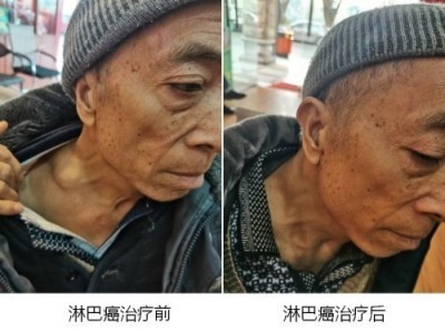 2026中国医学功勋人物报道 广西百色市杨忠雅治疗各种癌症有成就