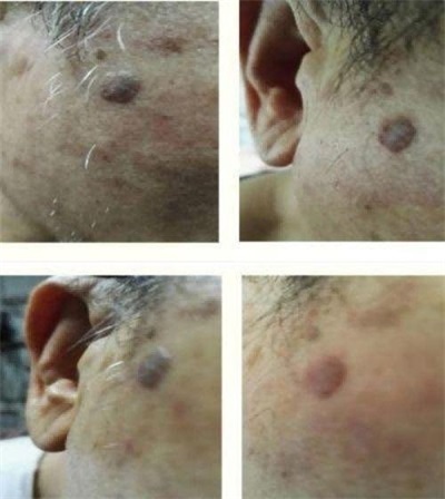 量子氢氧健康   第一人长寿哥(廖永贵) 让科学量氢氧品牌走向世界!