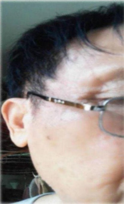 量子  氢氧健康第一人长寿哥(廖永贵)    让科学量氢氧品牌走向世界!