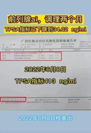金秀瑶族灯草灸疗法瑶医药非物质文化遗产传承人---赵衷民
