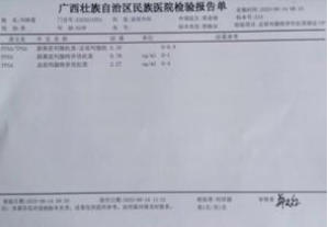 金秀瑶族灯草灸疗法瑶医药非物质文化遗产传承人---赵衷民