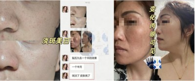 一款市面上难寻踪迹的神秘膏贴！ 五九生八卦子母针灸贴