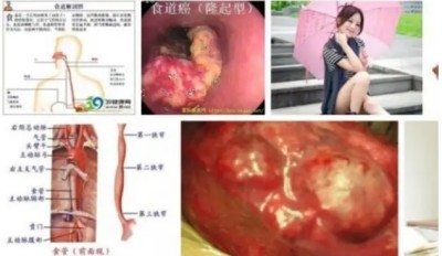 冉明医师创新国医精粹 铺就患者“健康之路