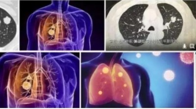 冉明医师创新国医精粹 铺就患者“健康之路