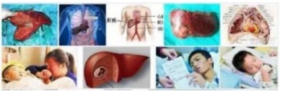 冉明医师创新国医精粹 铺就患者“健康之路