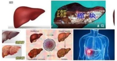 冉明医师创新国医精粹 铺就患者“健康之路