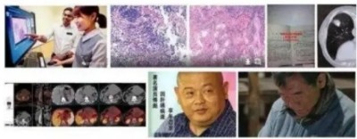 冉明医师创新国医精粹 铺就患者“健康之路