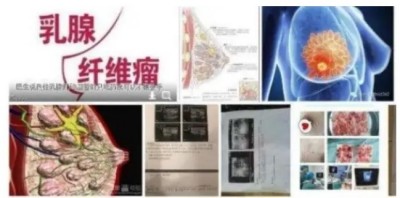 冉明医师创新国医精粹 铺就患者“健康之路