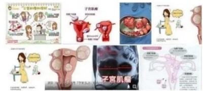 冉明医师创新国医精粹 铺就患者“健康之路