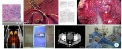 冉明医师创新国医精粹 铺就患者“健康之路