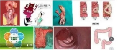 冉明医师创新国医精粹 铺就患者“健康之路