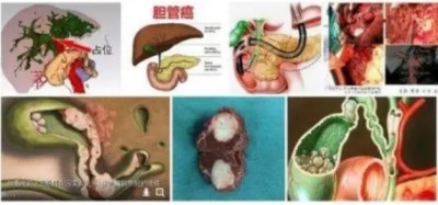 冉明医师创新国医精粹 铺就患者“健康之路