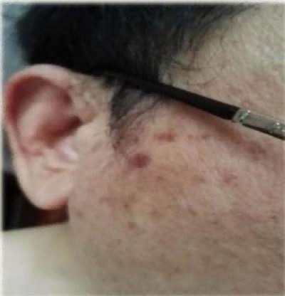 现代科技量氢氧元素绿色自然疗法！(廖永贵院士)