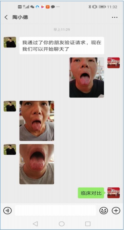 广西中医特色疗法传承导师——梁爱瑟