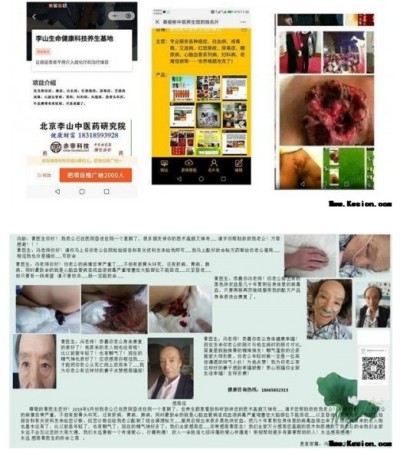 国宝级中医肿瘤专家——黄俊彬